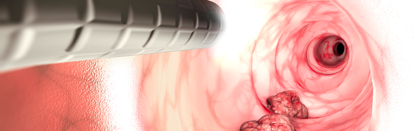 GI Cancer Visualization